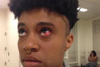 Stephanie Dorceant, after she says an off-duty cop beat her, then had her arrested for assault.